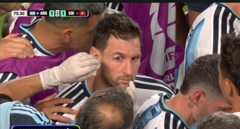 Lionel Messi treated for bloodied eye on touchline